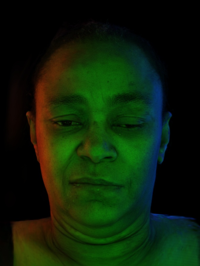 Refer to caption