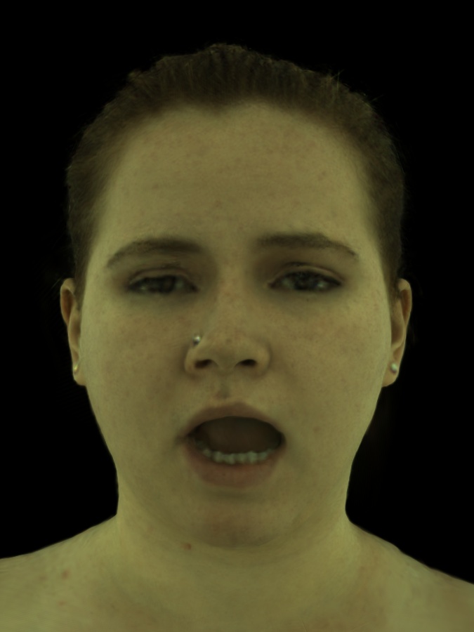 Refer to caption
