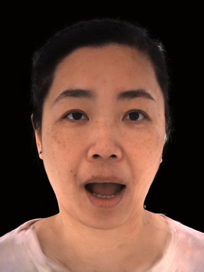 Refer to caption