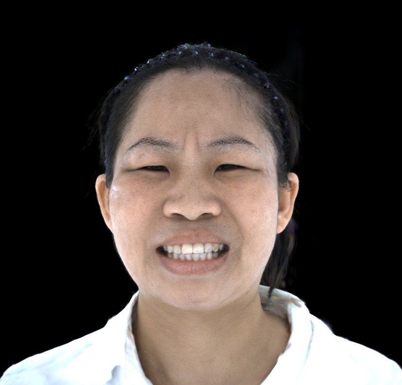 Refer to caption