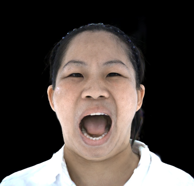 Refer to caption