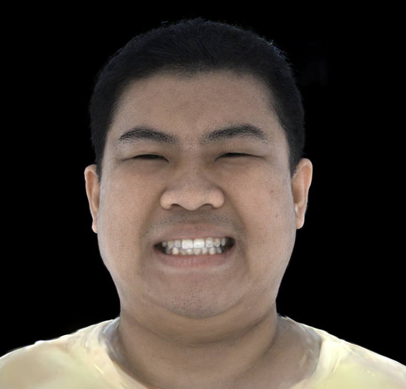 Refer to caption
