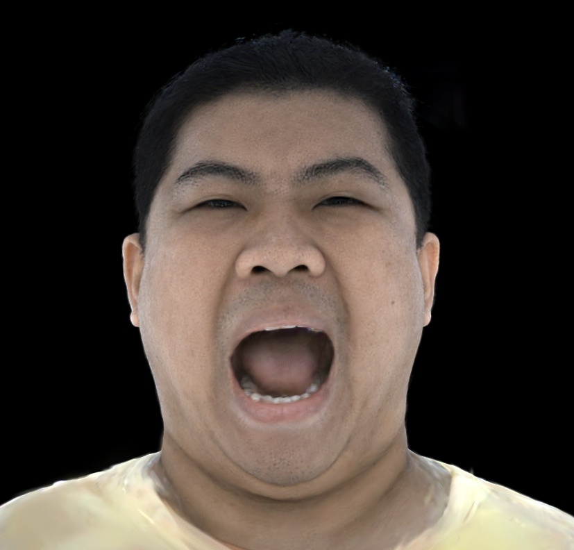 Refer to caption