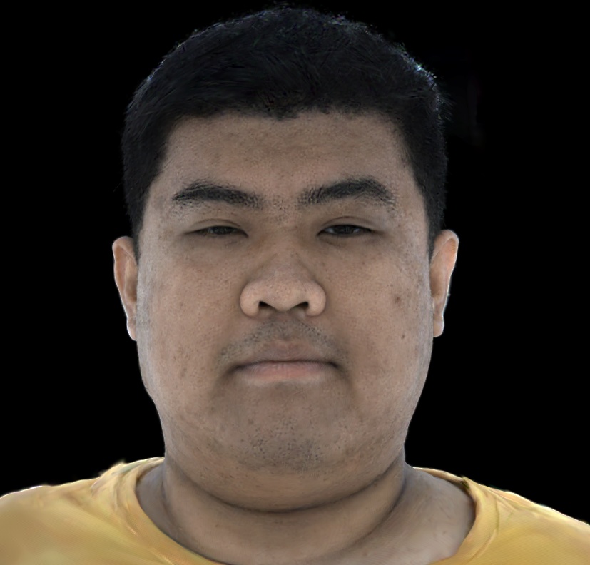 Refer to caption