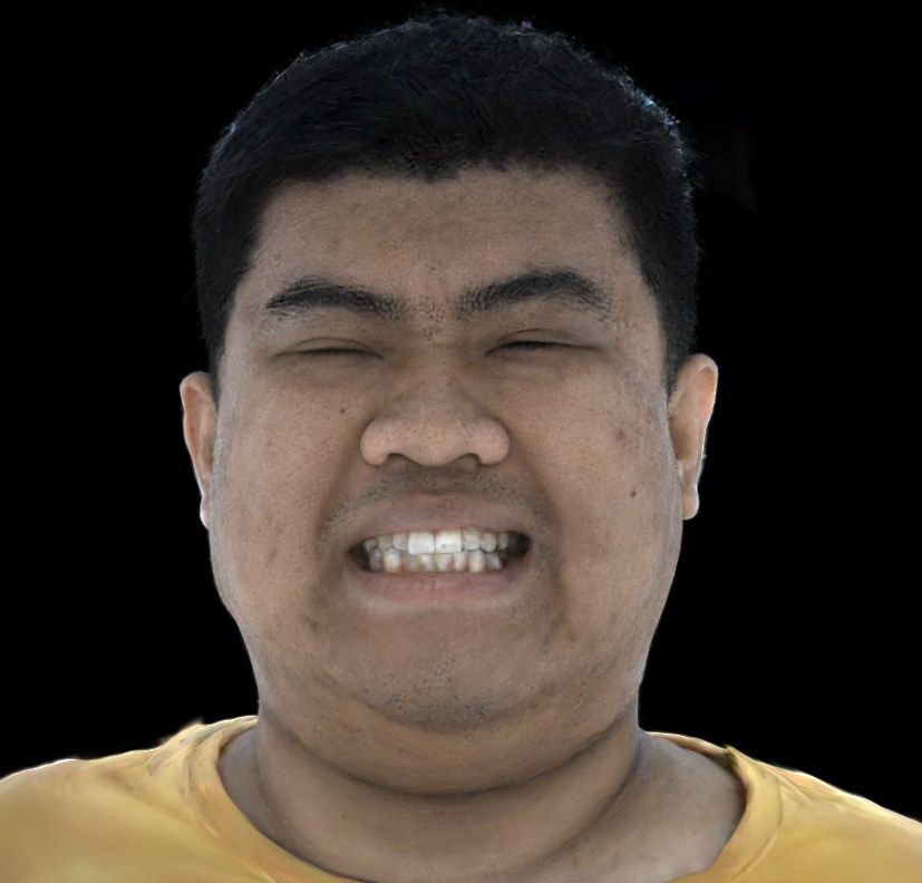 Refer to caption