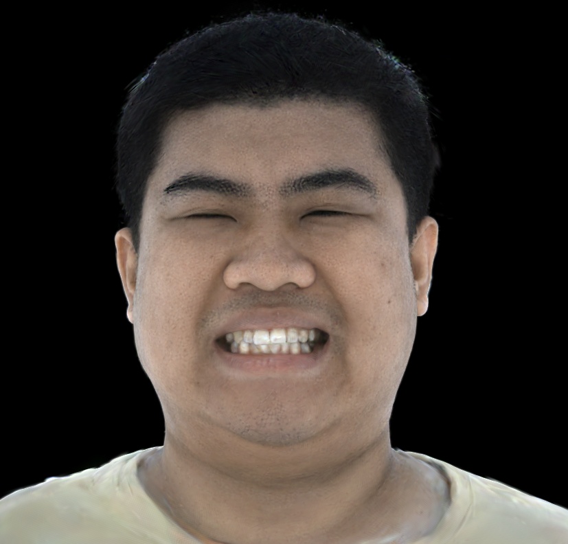 Refer to caption