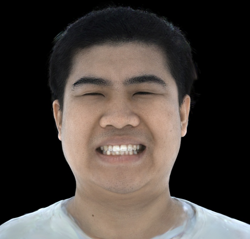 Refer to caption