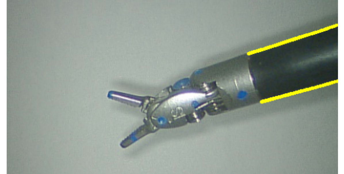 Refer to caption