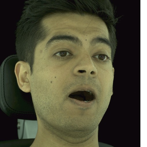 Refer to caption