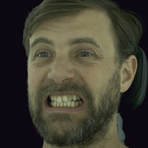 Refer to caption