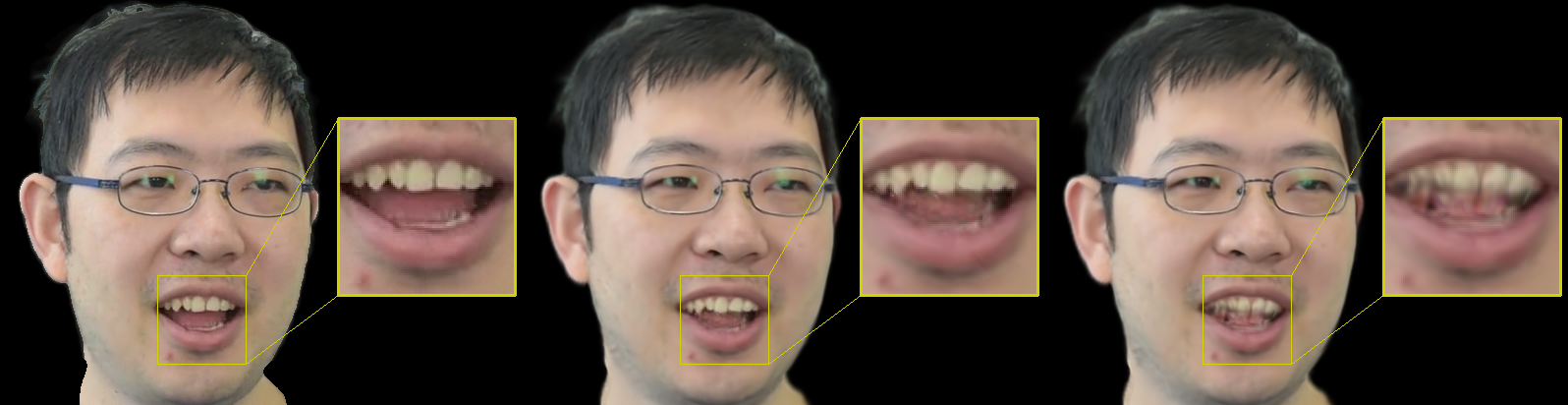 Refer to caption