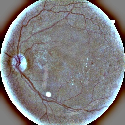 Refer to caption