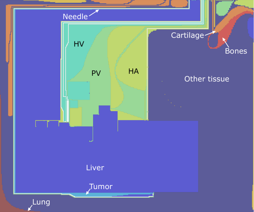 Segmentation embedding where each segment is colored according to the tissue type. The individual segments are labeled by the tissue type to provide a color map.