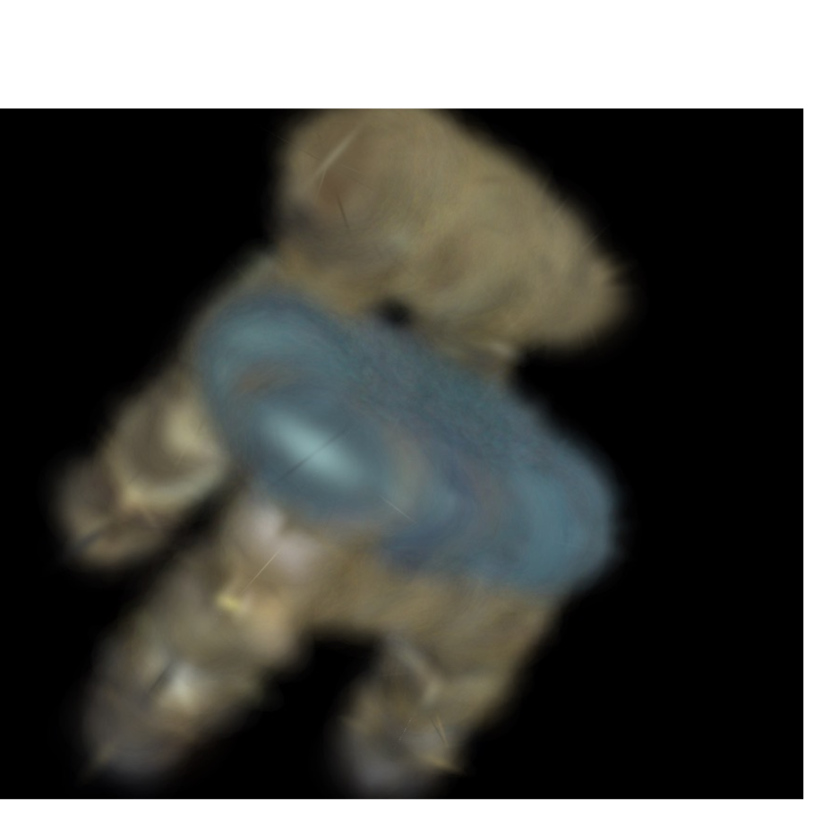 Refer to caption