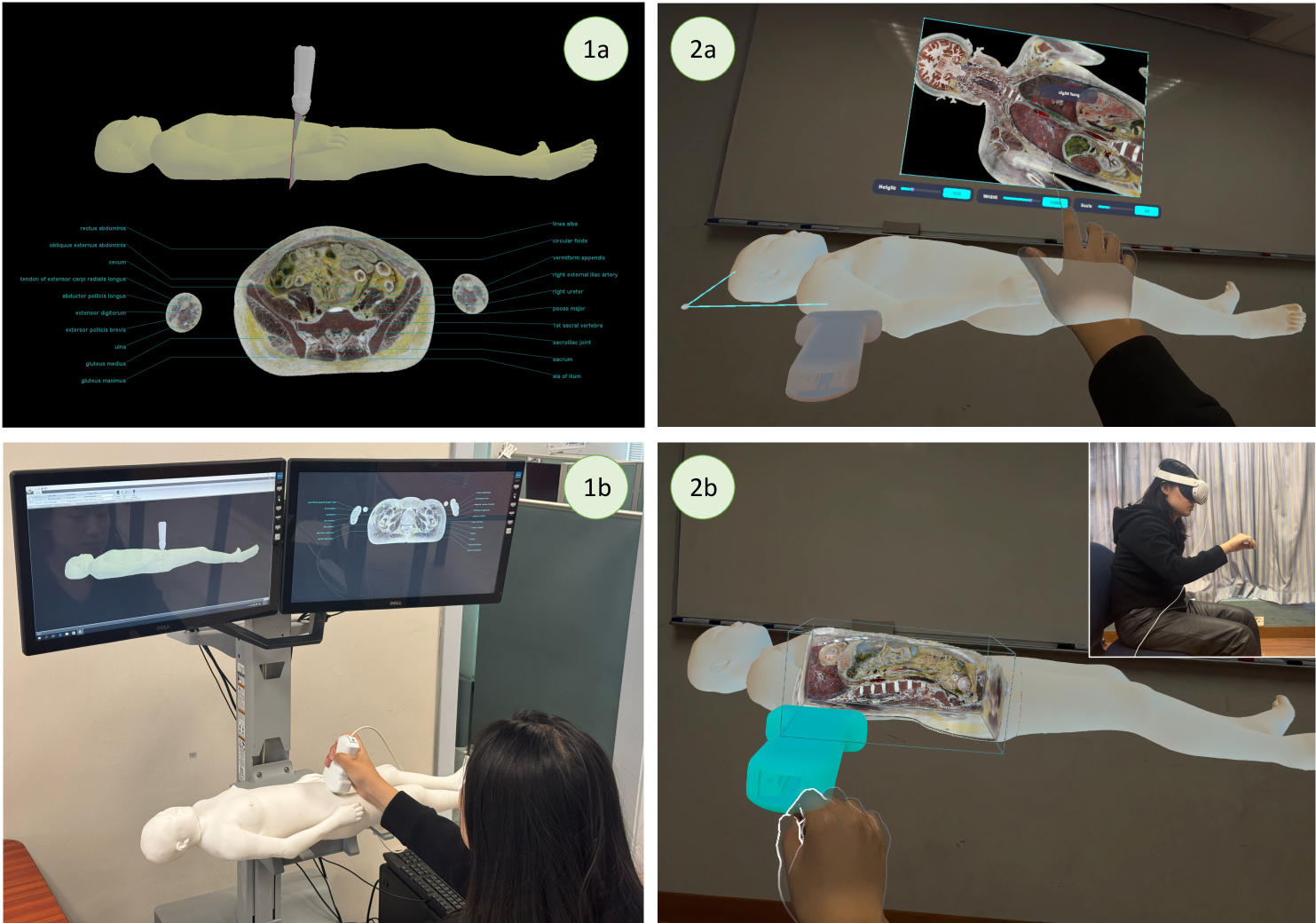 The evolution of CvhSlicer, showcasing an old PC-based system and a recent XR-based system for immersive and interactive visualization.