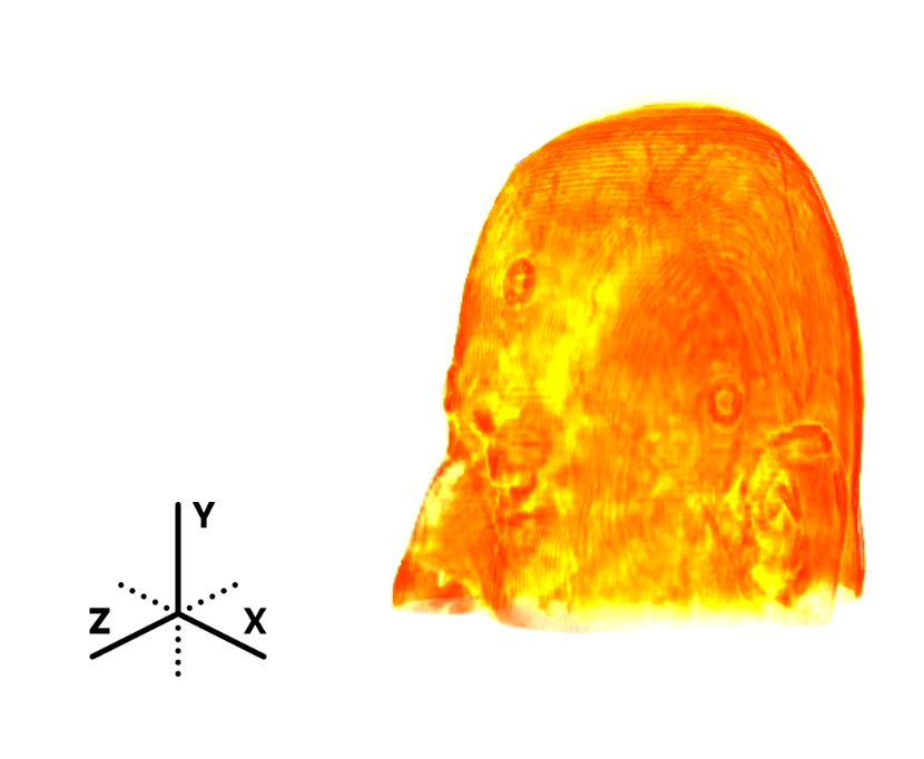 Refer to caption